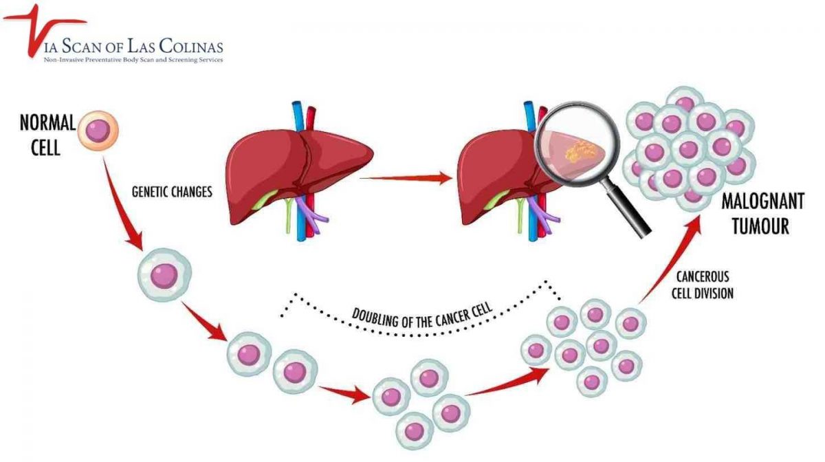 Liver-Cancer-Symptoms-1-1200x672.jpg